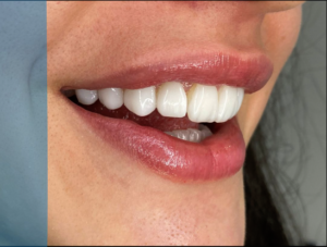 Captura de Tela 2024-11-23 às 15.03.46